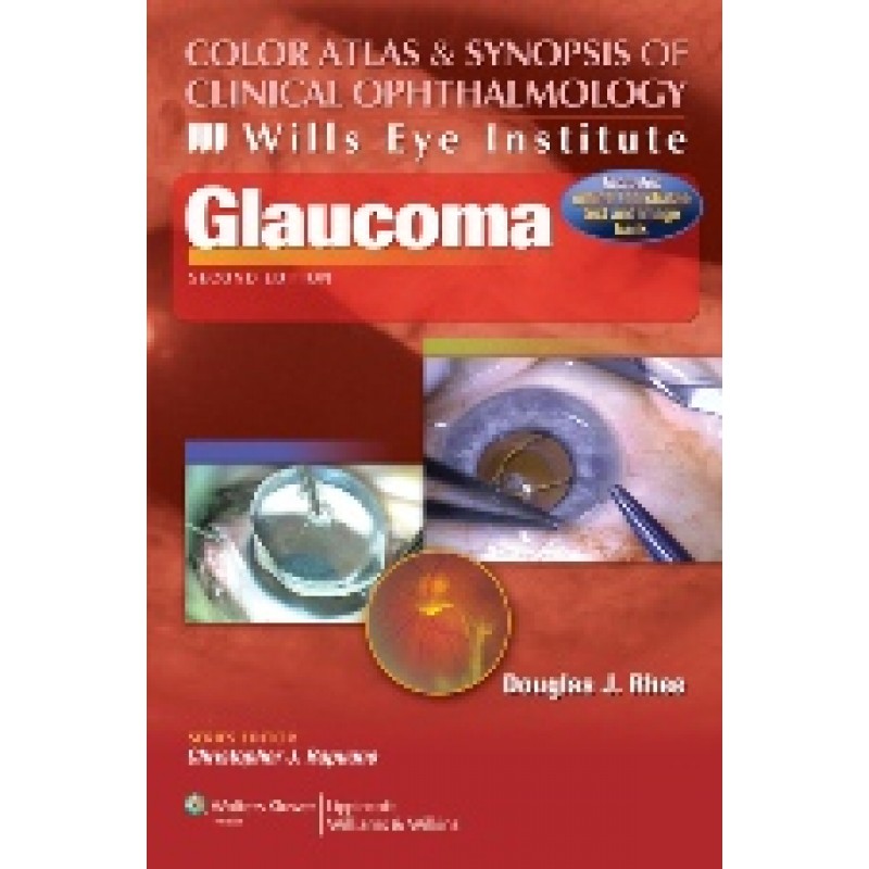 Color Atlas and Synopsis of Clinical Ophthalmology - Wills Eye Institute - Glaucoma